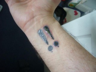 tatuagem_infeccionada