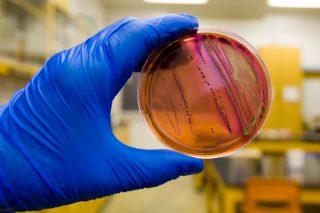 ecoli