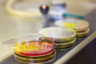 Bacteria growing on a petri plate.