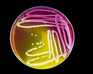 Bacteria growing on a petri plate.